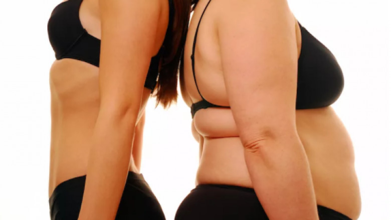 The Top 3 Most Influential Cavitation Machine From Suerbty