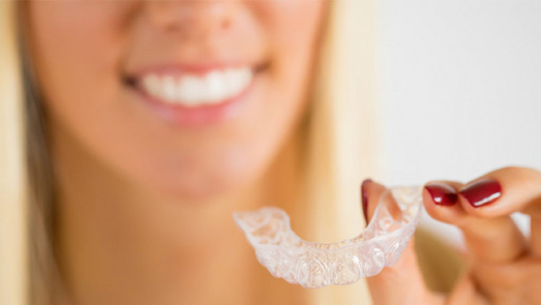 What Are The Different Kinds Of Braces?