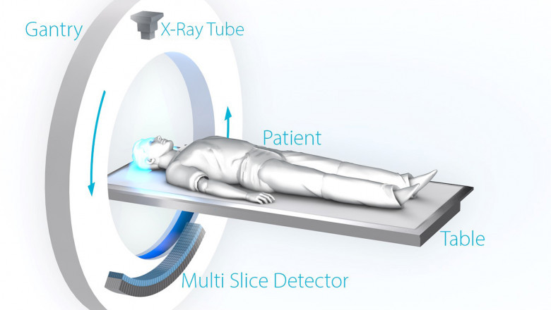 CT Scanner Market Share, Assumptions and Acronyms, Growth Drivers, Demand Risk Analysis and Forecast to 2029