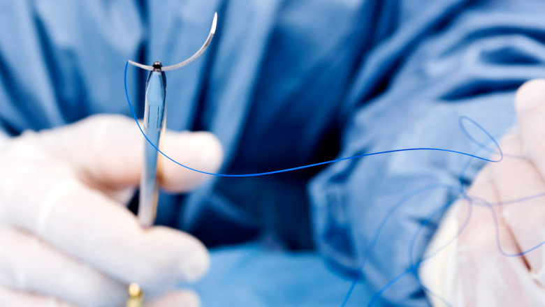 Suture Needles Market Forecast from 2022 to 2027