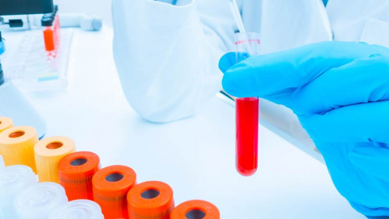 Clinical Laboratory Tests Market Key Leaders, Emerging Technology, Competitive Landscape by Regional Forecast to 2029
