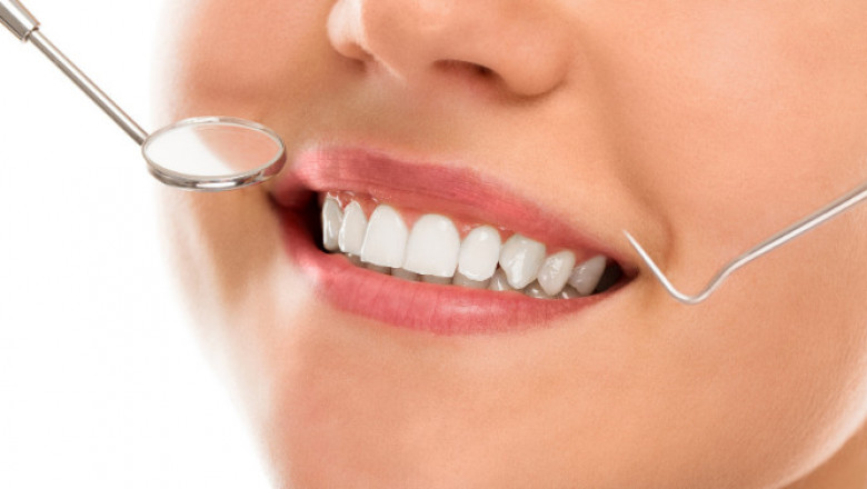 The Benefits Of Tooth Colored Restoration For You