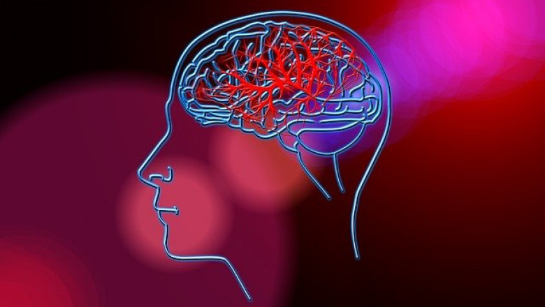 Ischemic stroke Market Revenue 2022: Size, Share, Analysis and Forecast-2027