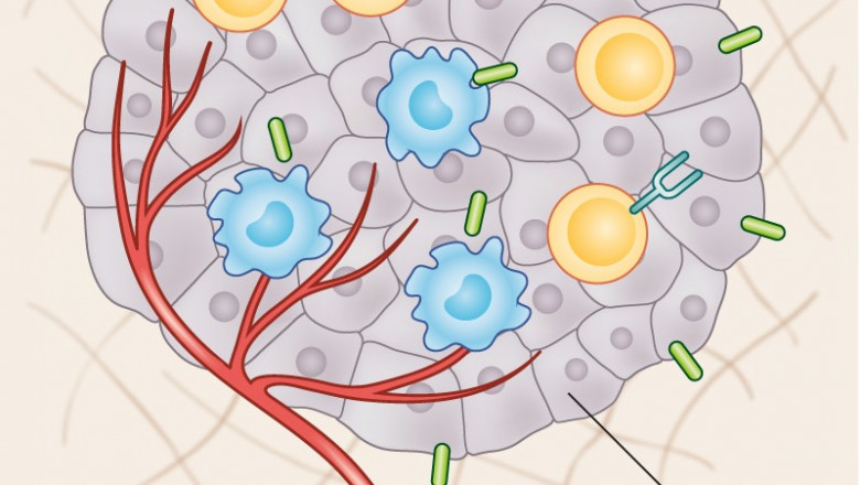 Tumor Infiltrating Lymphocytes Market Size Global Industry Demand, Share, Key Findings, Key Trends, Regional Analysis, Key Players Profiles, Future Prospects and Forecasts to 2027