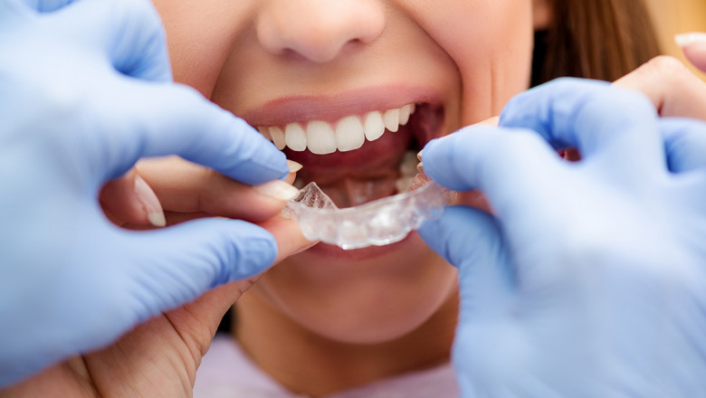 Where Can I Find The Best Orthodontist Near Me?