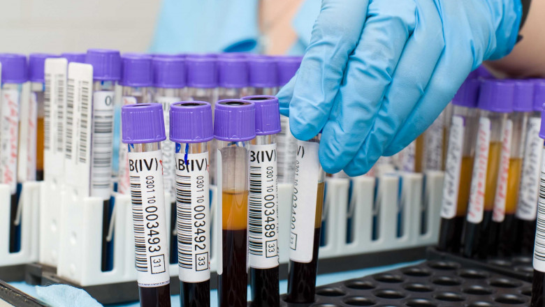 In order to monitor proper kidney function, Bilirubin Colorimeter Assay are used to measure the amount of bilirubin in the blood.
