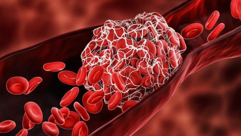 Anticoagulant reversal Drugs Market by Organizational Size, Industry Verticals, Opportunity Analysis, and Industry Forecast