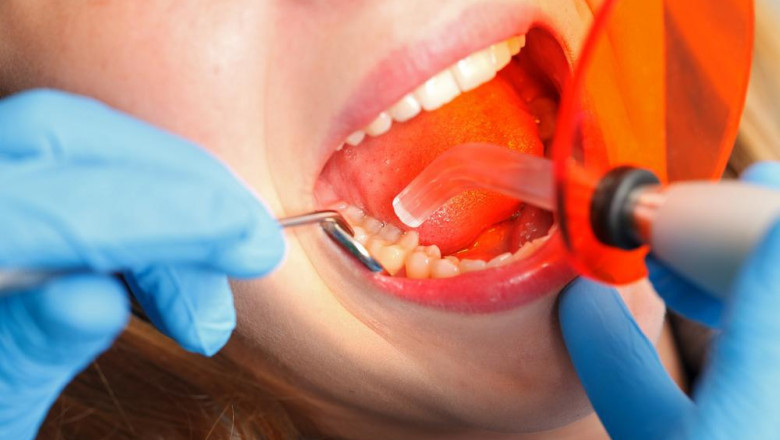 Restoration Dentist in 35115: How to Choose the Right One for You