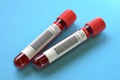 Blood Testing Market Size, Development, Key Opportunity, Application & Forecast