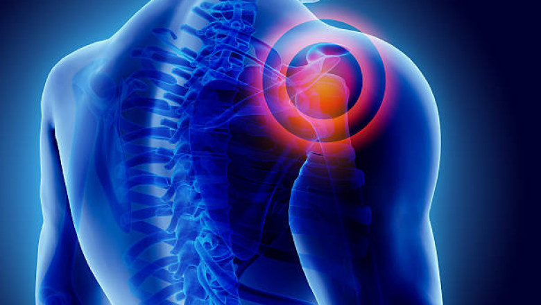 Why Muscle Building Is Great For Your Health.