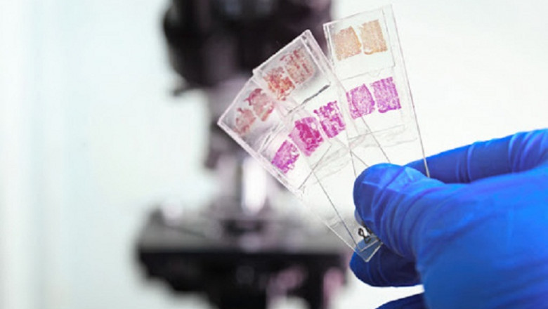 Anatomic Pathology Market Size, Development, Share and Forecast with Covid19 Impact | Agilent Technologies, Inc (U.S.), Sakura Tech (Singapore)