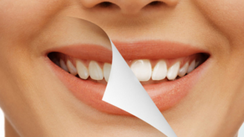 Different Types of Cosmetic Dental Procedures - Tower House Dental Clinic