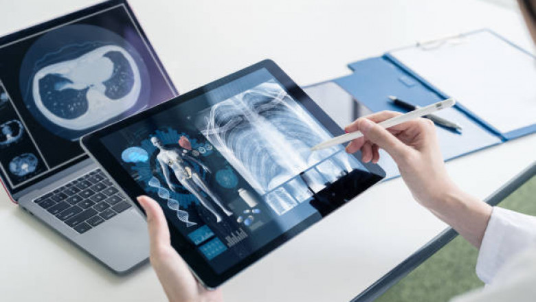Digital Pathology Market With Complete SWOT Analysis by Forecast From 2022 to 2027