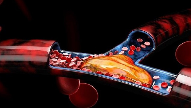 Global Aspiration Catheters Market Trends, Competitive Landscape, SWOT Analysis and Growth by 2022-2027