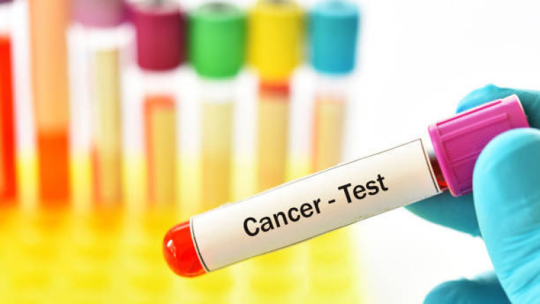 Carcinoembryonic Antigen Market - The Biggest Trends to Watch out for 2022-2027