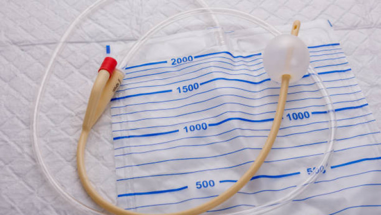 Catheters Market Comprehensive Growth Strategies, In – depth Analysis, Key Players and Geographical Regions to 2027