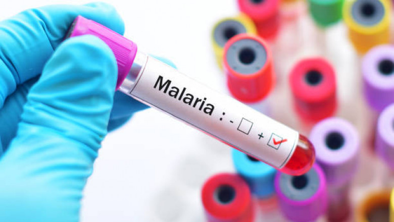 Malaria Diagnostics Market Comprehensive Growth Strategies, In – depth Analysis, Key Players and Geographical Regions to 2027