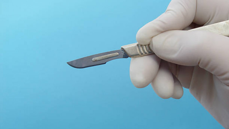 Surgical Scalpel Market Comprehensive Growth Strategies, In – depth Analysis, Key Players and Geographical Regions to 2027