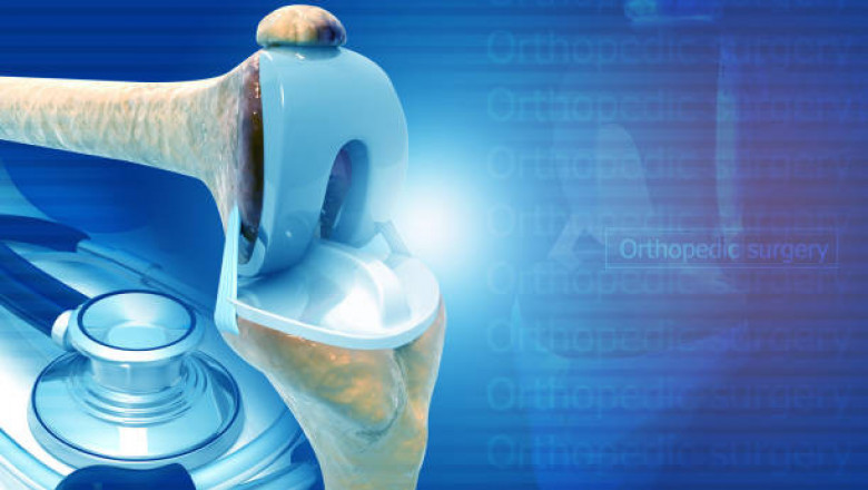 Medical Implants Market Future Scenarios and Business Growth Segment, Drivers, Trends, Forecast to 2027