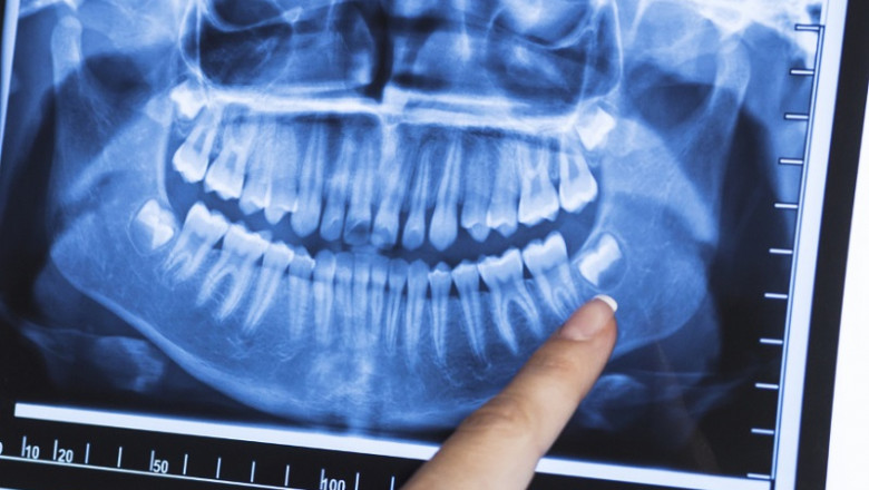 North America Dental Imaging Market Scope and Market Size