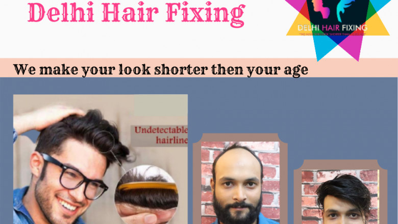 The best hair loss treatments for men