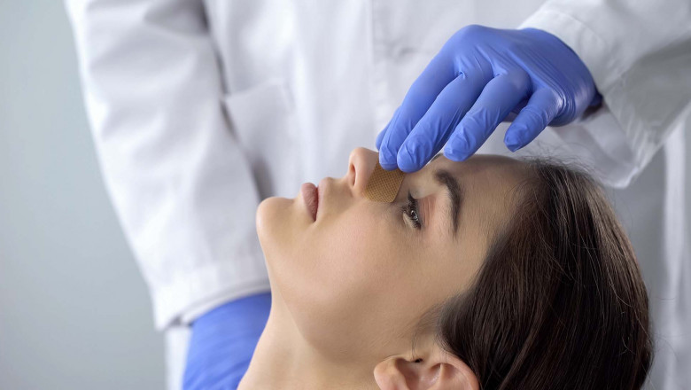 The Benefits of Non-Surgical Rhinoplasty (Nose Job)