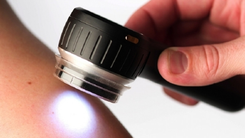 Global Dermatoscope Market Potential Growth, Share, Demand, Analysis of Key Players & Forecasts to 2028