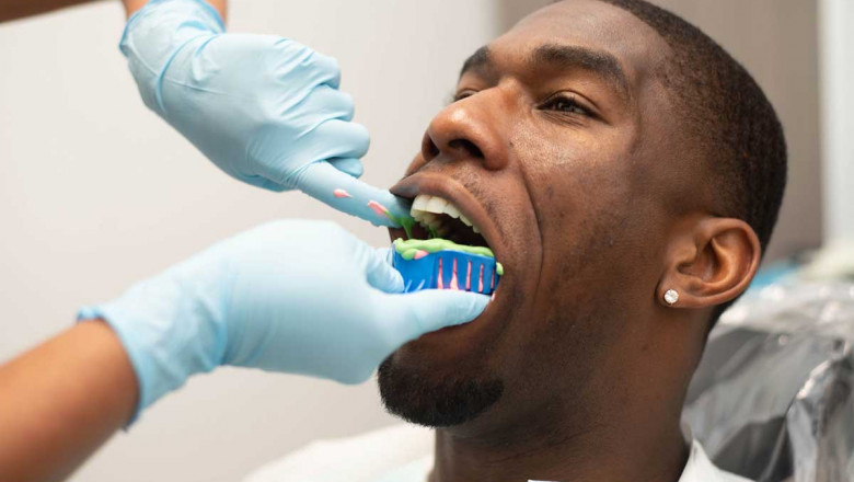 How To Prepare For Root Canal Treatment?