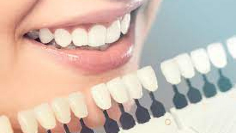 What Is The Use Of Partial Dentures?