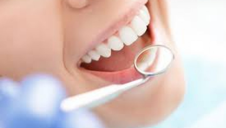 Why you need to visit your Dentist every 6 months?
