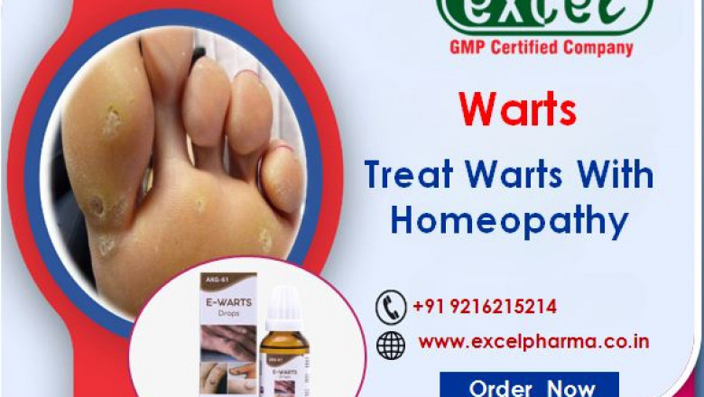 Homeopathic Wart Treatment