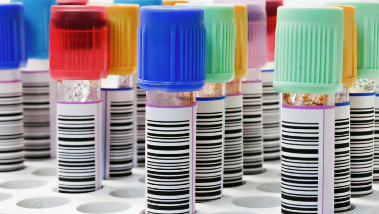 Biobank Market competitive Analysis