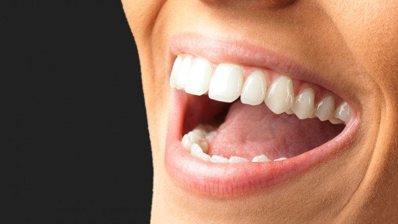 What Are The Various Teeth Bleaching Or Whitening Products Available?