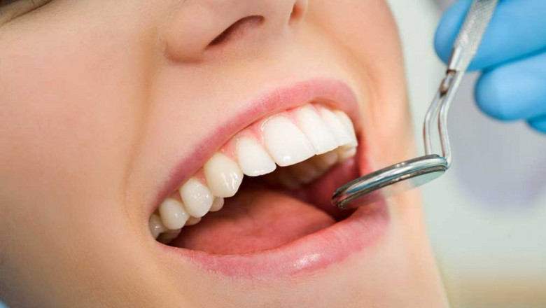 What Are The Beneficial Aspects Of Invisalign Clear Aligners?