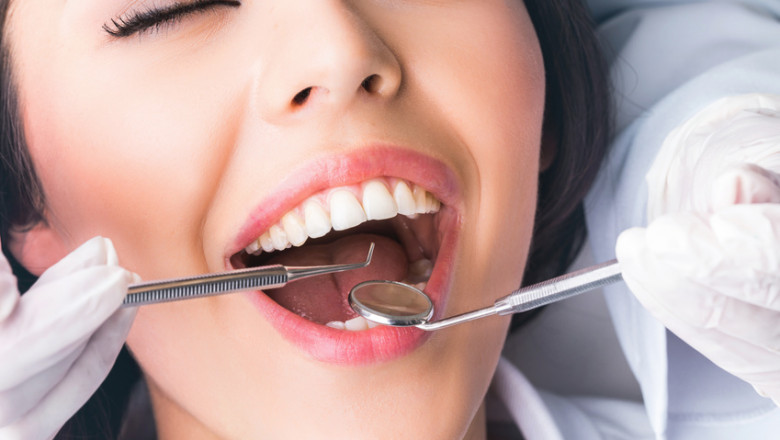 What Does Deep Dental Cleaning Procedure Involve?
