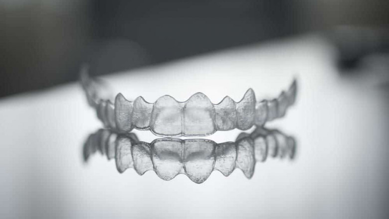 Is Invisalign Worth Treatment To Have A Straight Smile?