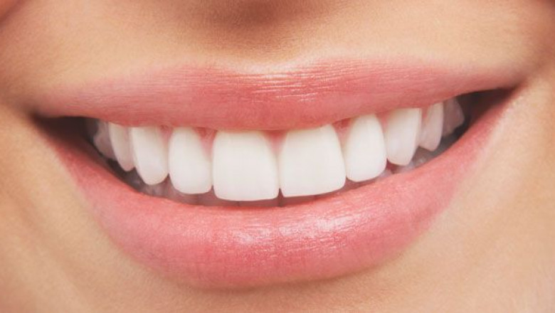 Affordable dentures Houston
