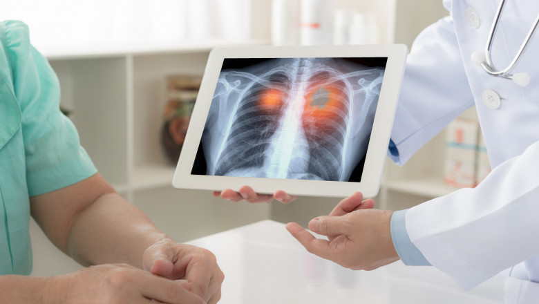 What is the Role of Pathologists in Cancer Diagnostics?