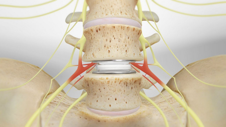 A Quick Guide to Some Popular Spine and Brain Treatments in San Antonio, TX