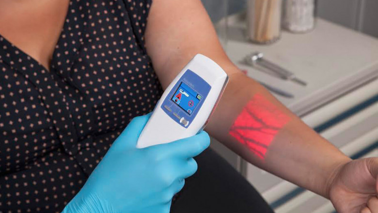 Using a vein finder, patients can detect veins without feeling uncomfortable