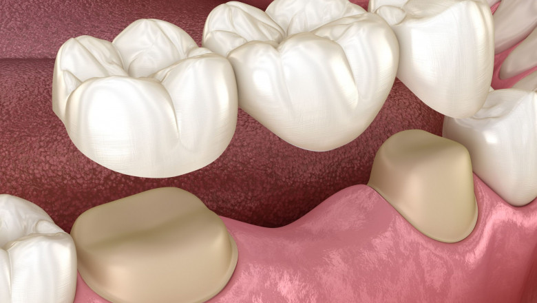 What is TMJ?