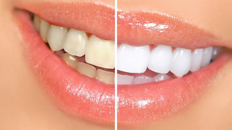 Excellent Benefits Of Cosmetic Dentistry: Tower House Dental Clinic