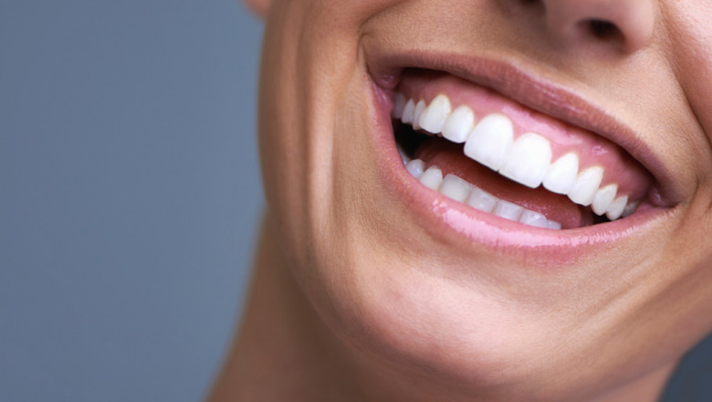 Why Dental Crowns are needed?