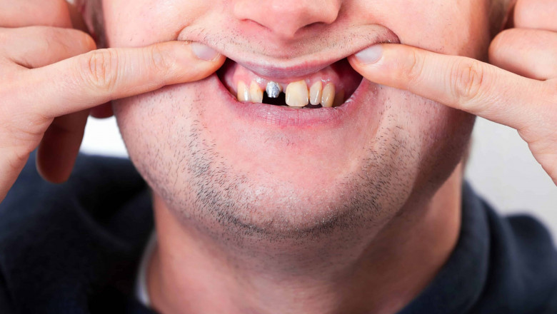 What to Expect During Regular Checkups?
