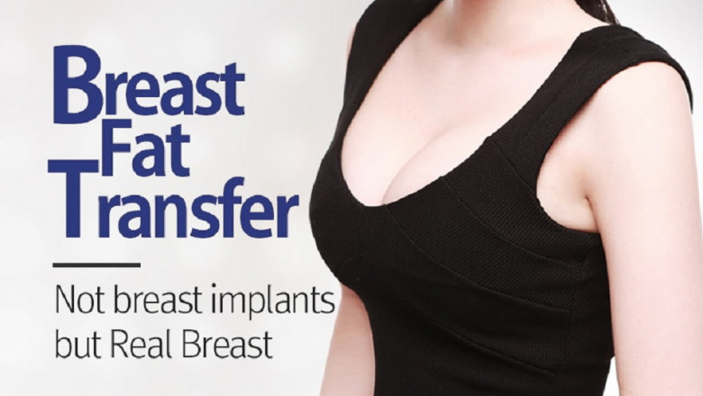 Did you know this about fat grafting?