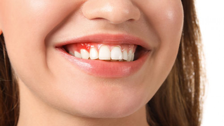 Why Should You Visit A Good Dentist At Regular Intervals?