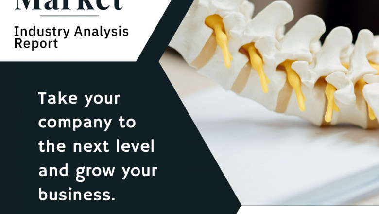 Spinal Surgery Devices Market Size, Growth and Trends - Report 2025
