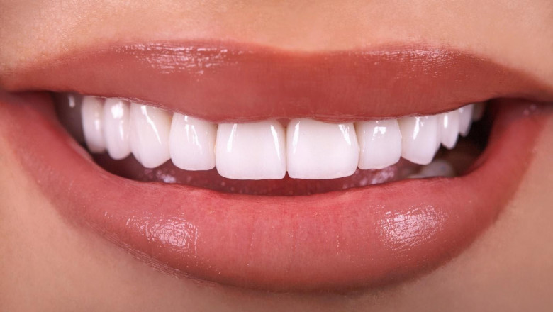 Why Do Dentists Not Use Lasers?