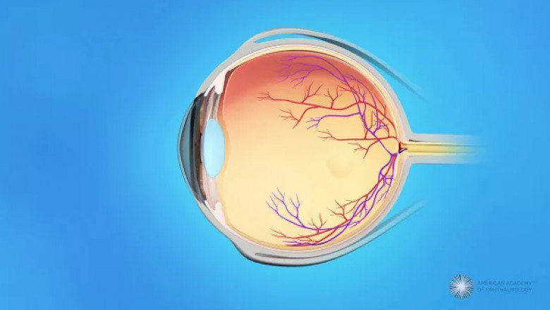 Retinal Specialist Houston | Shaikhmd.com