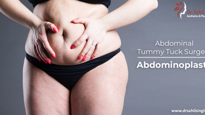 Abdominoplasty: when is it indicated and how is the surgery performed?